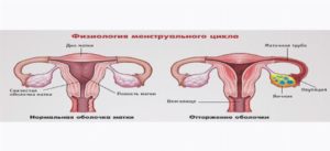 Долго идут месячные и болит грудь