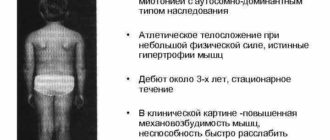 Миотония Томпсена инвалидность