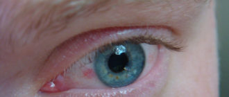 Что-то появилось в углу глаза