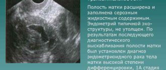 Что значит полость матки расширена за счет неоднородного содержимого
