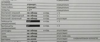 В анализе мочи лейкоциты, эритроциты, белок