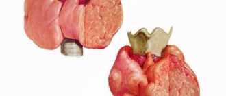 Диффузно узловые изменения щитовидной железы