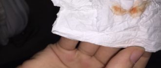 На фоне флуомизина кровенистые выделения