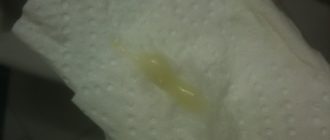 Выделения прозрачного цвета и бурлит живот внизу