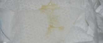 Выделения у маленького ребёнка