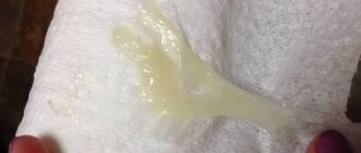 Выделения при беременности 3-4 недели