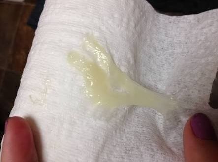 Выделения при беременности 3-4 недели