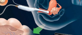 Можно ли забеременеть от спермы на руке? Или