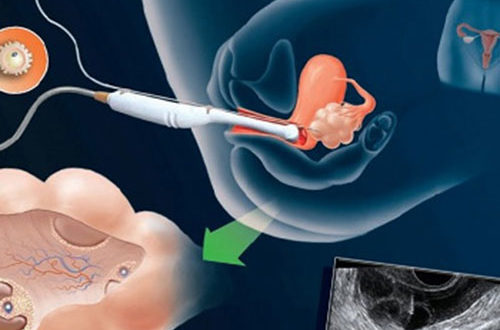 Можно ли забеременеть от спермы на руке? Или