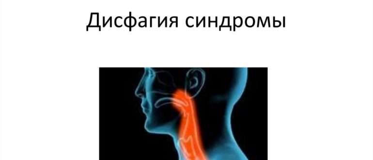 Дисфагия или нервы?