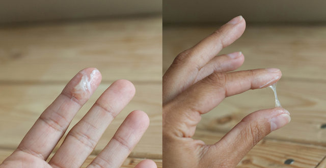 Выделения, похожие на сопли