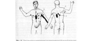 Дикие боли в области сердца