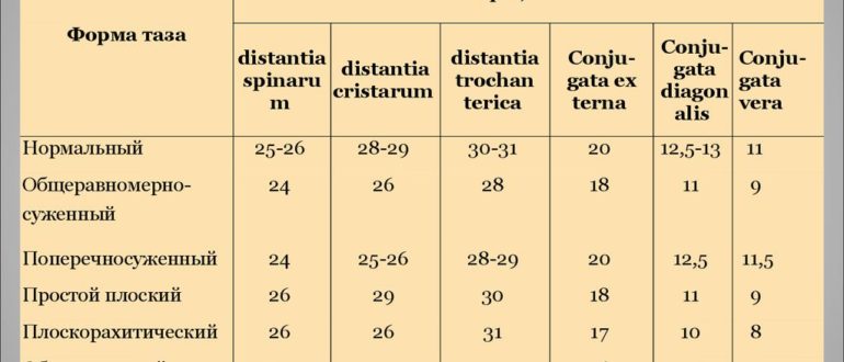 Узкий таз при беременности