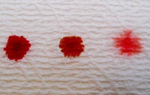 Месячные пришли раньше. Очень жидкие, алого цвета, обильные