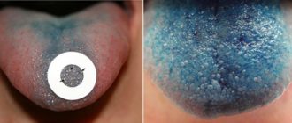 Две черные точки на языке