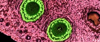 Множество фоликул