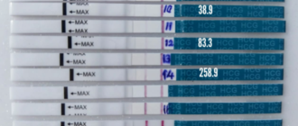 ЭКО и ХГЧ в динамике