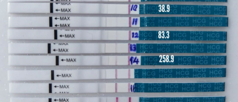 ЭКО и ХГЧ в динамике