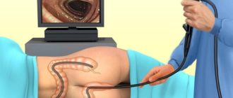 Можно ли при простуде делать гастроскопию и колоноскопию?