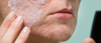 Дерматит и пилинг