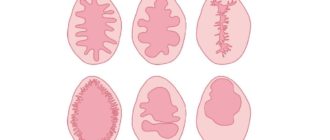 Могла ли девственная плева не порваться сразу?