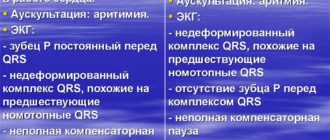 Экстрасистолы и перебои в сердце