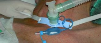 Дыхание при трахеостоме