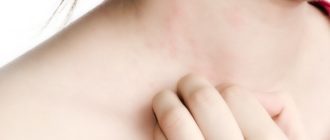 Может ли появится аллергия, если раньше не было?