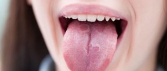 Что то на языке