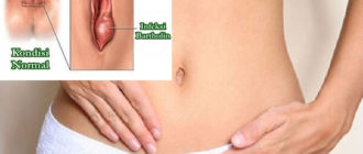 Воспаление нижней половой губы возле влагалища