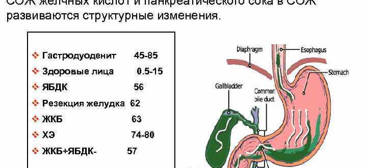 ДГР, прокинетики не действуют