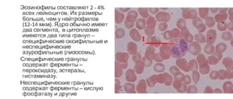 Эозинофилы 14