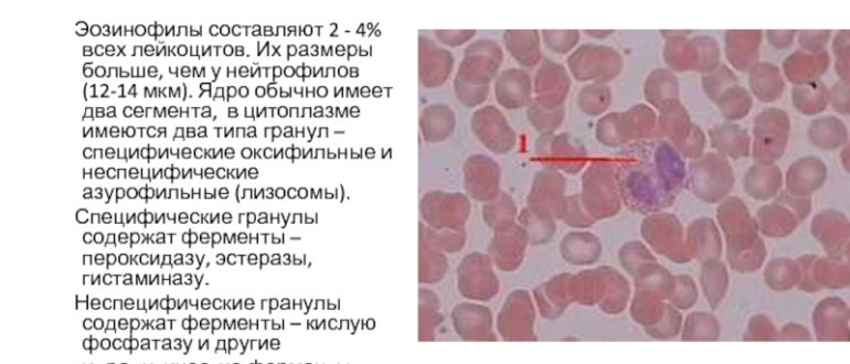 Эозинофилы 14