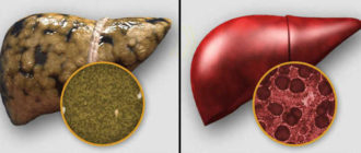 Воздействие КОК на печень