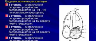 Митральная и трикуспидальная регургитация