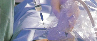 Делать ли пункцию во время беременности