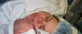 Второе кесарево через 5 лет