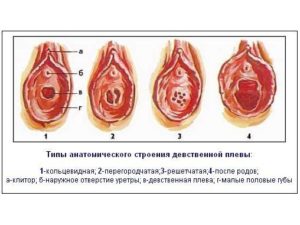 Возможна ли беременность через девственную пленку