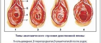 Возможна ли беременность через девственную пленку