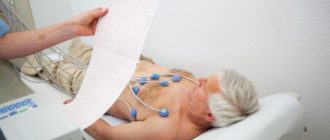 ВВК, аварийная экг