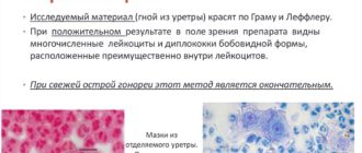 Методы диагностики трихомонад и гонококков