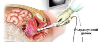 Узи матки и придатков