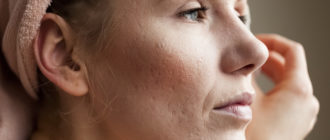 Кожа в очень плохом состоянии, что делать?