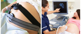 Эхо кг сердца плода