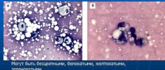 Выделения из соска, цитология