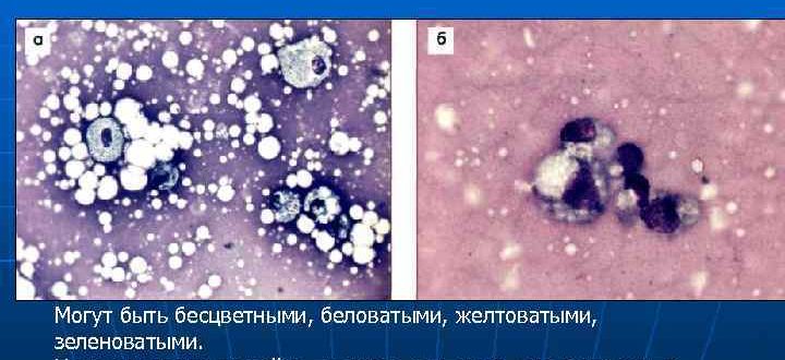 Выделения из соска, цитология