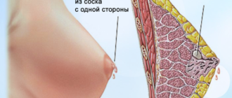 Выделения из правой груди
