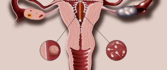 Моей жене поставили спираль чи можна заниматся половим актом