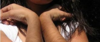 Много темных волос на теле