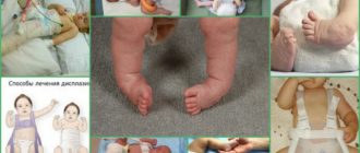 Диагноз нтбс